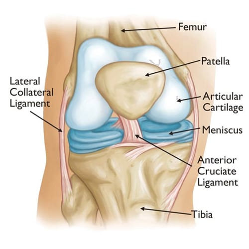 knee replacement diagram