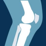 Orthopedic Knee Conditions Icon
